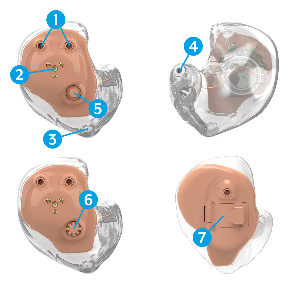 Diagram showing a custom in-the-ear hearing aid from different angles